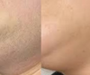 Spécialement formulée pour les poils liés au SOPK, pour une peau naturellement lisse