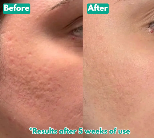 Velora Microcrystal™ Serum PM Duo | See smoother skin in just 3–5 nights