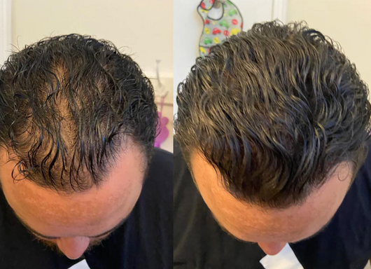 Velora Crème Densité™