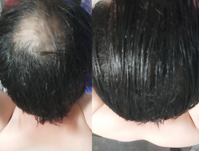 Velora Crème Densité™