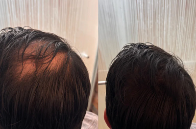 Velora Crème Densité™
