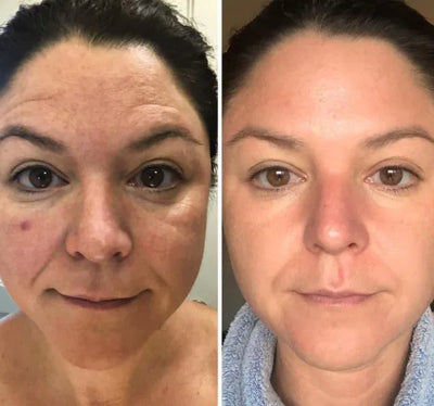 Velora PDRN Collagen Volume Balm