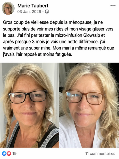 Velora™ | Sérum Anti-Rides et Anti-Cernes. Effet immédiat en 3 minutes