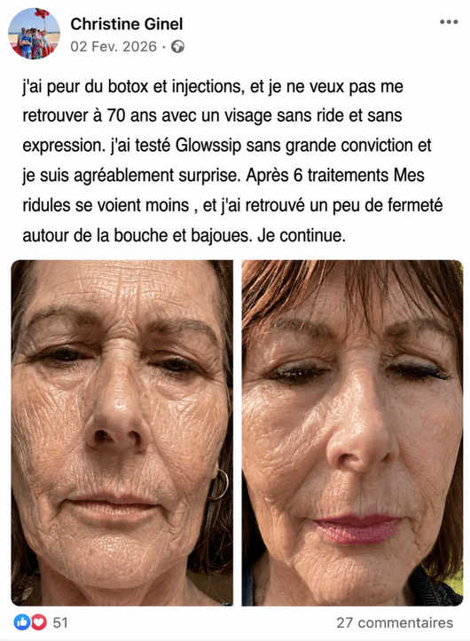 Velora™ | Sérum Anti-Rides et Anti-Cernes. Effet immédiat en 3 minutes