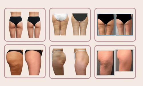 Velora Shape™ | Short Gainant Sans Couture