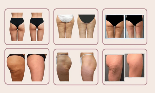 Velora Shape™ | Short Gainant Sans Couture