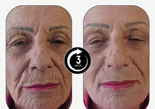 Velora™ |Effet immédiat en 3 minutes