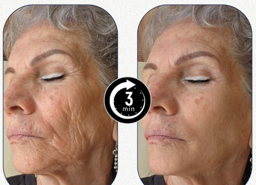Velora™ |Effet immédiat en 3 minutes