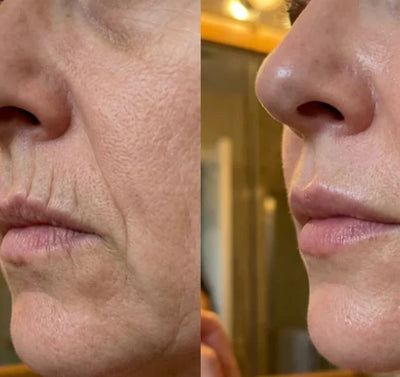 Velora PDRN Collagen Volume Balm