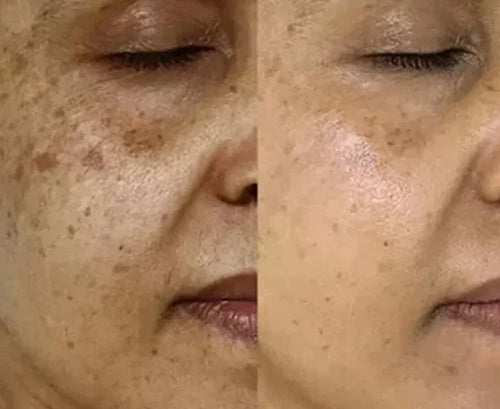 Velora PDRN Collagen Volume Balm