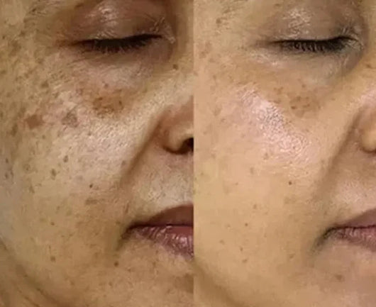 Velora PDRN Collagen Volume Balm
