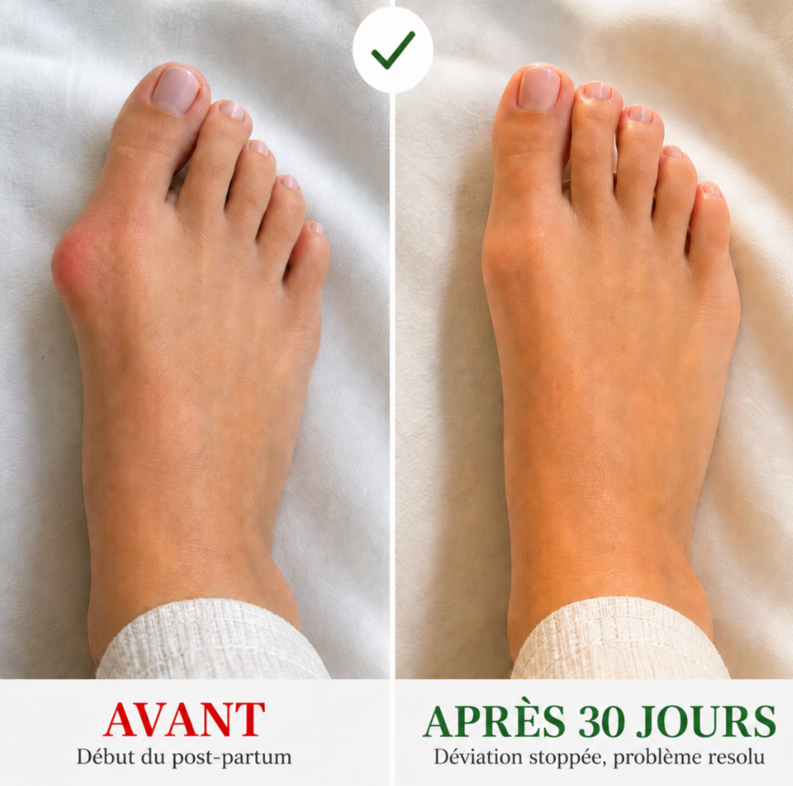 Le principe de l'appareil dentaire, appliqué au pied