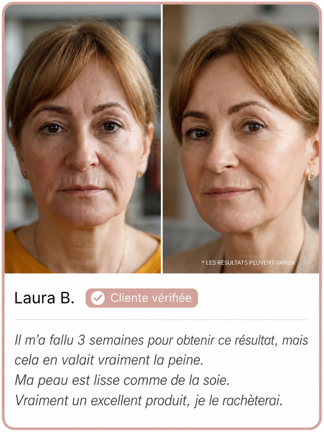L'effet d'un lifting, sans le cabinet
